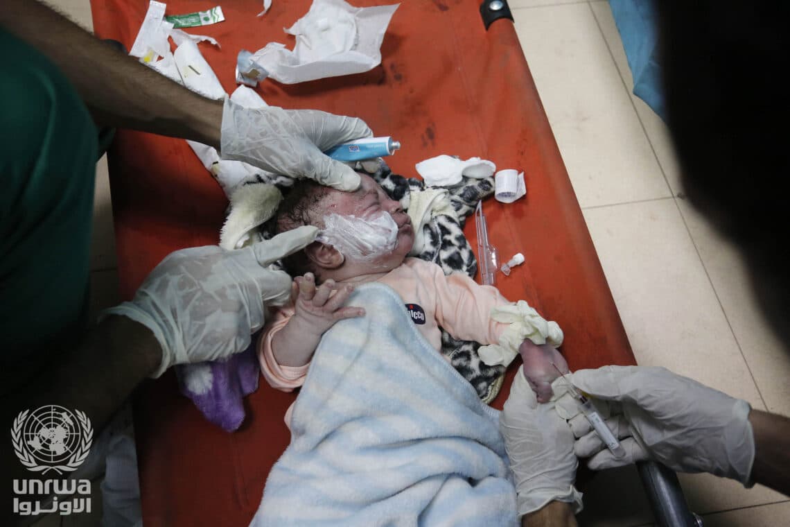 Palestijnse baby, gewond geraakt door een Israëlische luchtaanval in Deir el-Balah, Gaza Strip