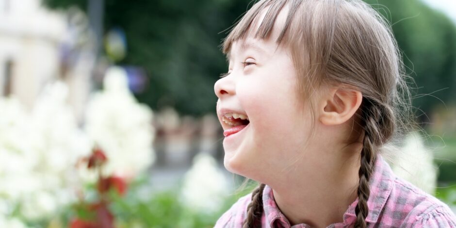 Lachend meisje met het syndroom van Down